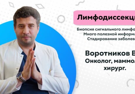Лимфодиссекция